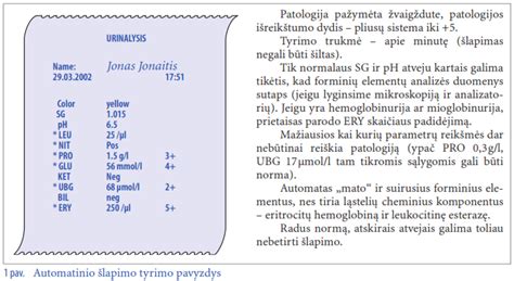 Bendrojo šlapimo tyrimo rodiklių lentelė