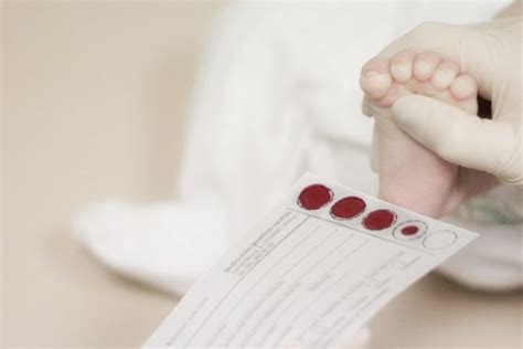 Naujagimio kulno pradurimas kraujo mėginiui paimti