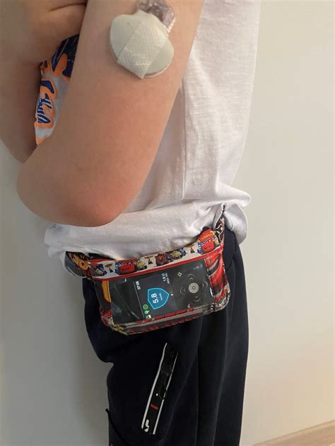 Vaikas su insulino pompos pagalba