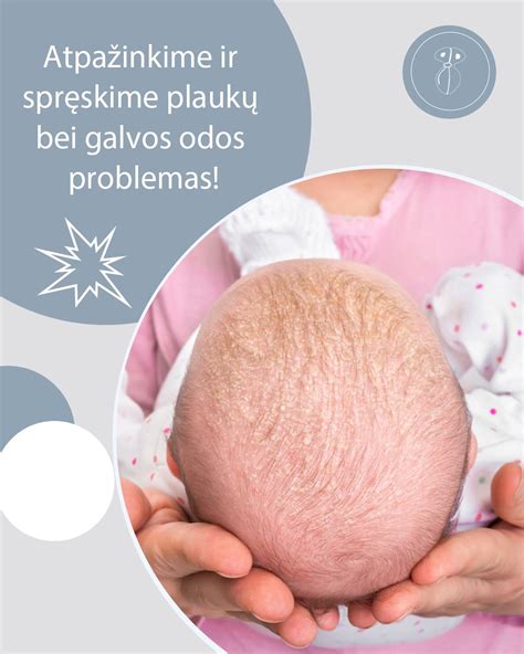 Grafikas, iliustruojantis vaikų sergamumo priežastis