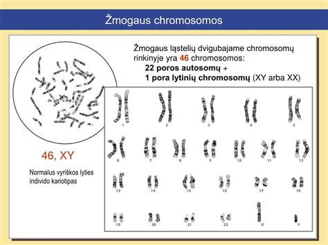 Žmogaus chromosomų poros