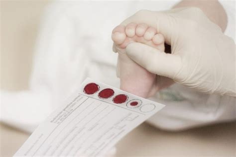 Naujagimio kulniukas kraujo tyrimui