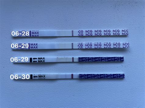 Žmogaus chorioninio gonadotropino (hCG) tyrimas