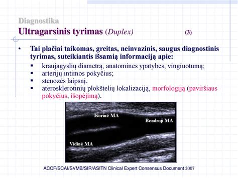 Ultragarsinis kepenų vaizdas
