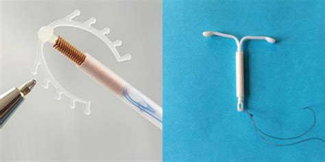 Hormoninės gimdos spiralės schema