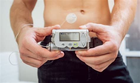 Schema, kaip veikia insulino pompa