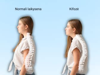 Nėščiosios laikysena ir svorio centro pasikeitimas