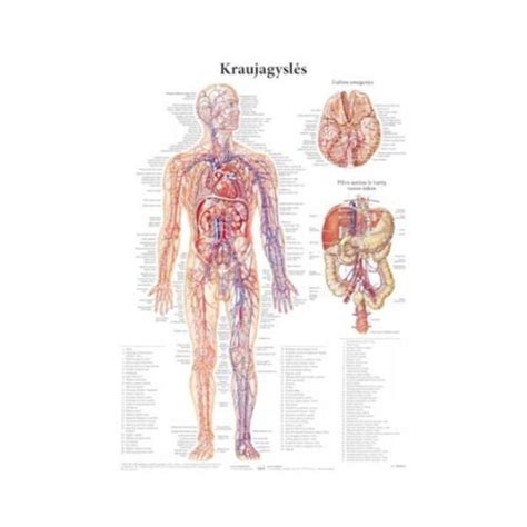 schematinis kraujagyslės pažeidimo vaizdavimas