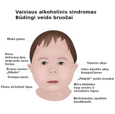 Jautraus vaiko bruožai