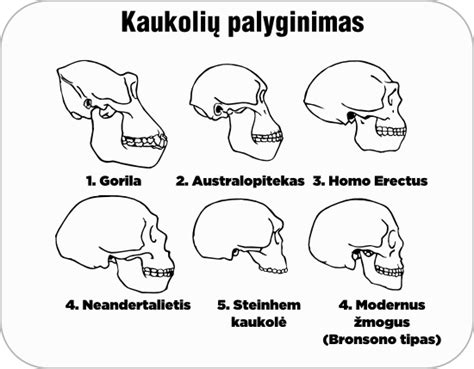 Naujagimio galvytės formos palyginimas
