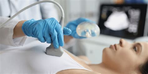 moters krūtis su strijomis