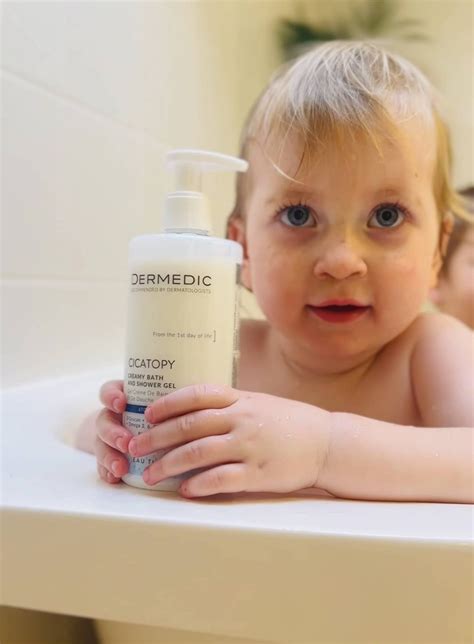 Vaikų odos sudirginimo priežastys