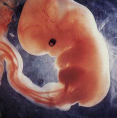 Vaisiaus vystymasis 8 nėštumo savaitę