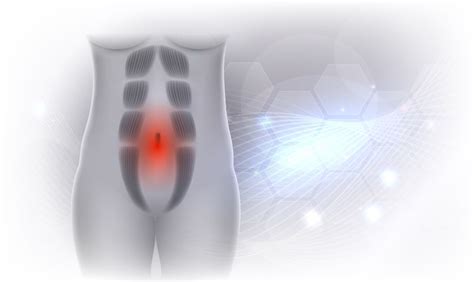 Nėščiosios pilvo raumenų diastazė