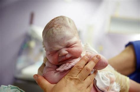 Naujagimio hipoglikemijos tyrimas