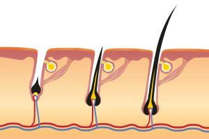 Schematinis plaukų augimo ciklo pavaizdavimas