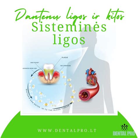 Schema, parodanti periodonto ligų ir nėštumo komplikacijų ryšį