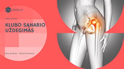 simptomai, rodantys klubo sąnario displaziją
