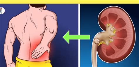 simptomai ir požymiai, rodantys gresiantį persileidimą