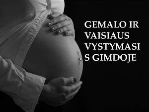 schematinis vaisiaus padėties gimdoje pavaizdavimas