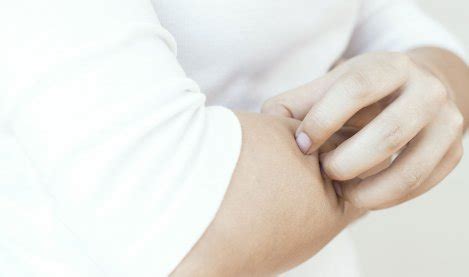 Kaip teisingai drėkinti odą sergant atopiniu dermatitu