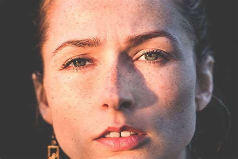 Moters veidas su pigmentinėmis dėmėmis