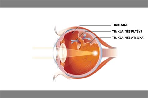 Schema, kaip veikia akies tinklainė