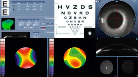 Nėščiosios akių patikrinimas