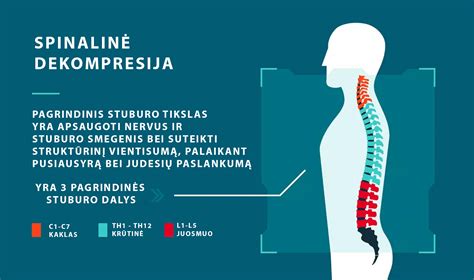 Spinalinės nejautros procedūros schema