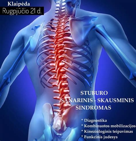 Schematinis stuburo apkrovimo palyginimas