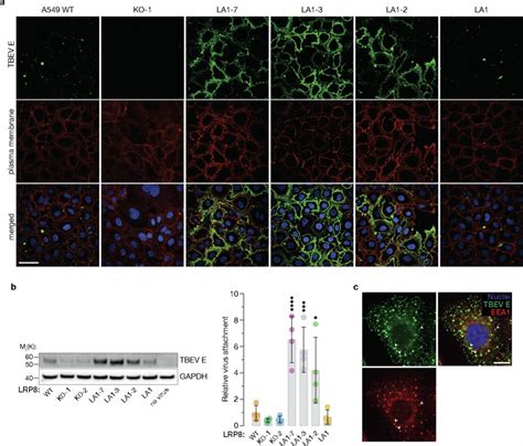Scheminis vaizdas, kaip eritrocitai patenka į šlapimo takus