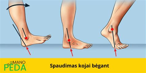 Pėdos laikysenos indekso (FPI) matavimas