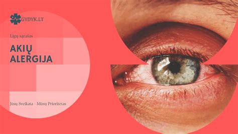 priežastys akių trūkčiojimui