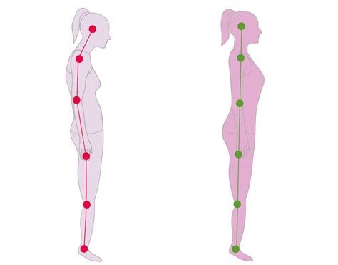Nėščiosios laikysena ir stuburas